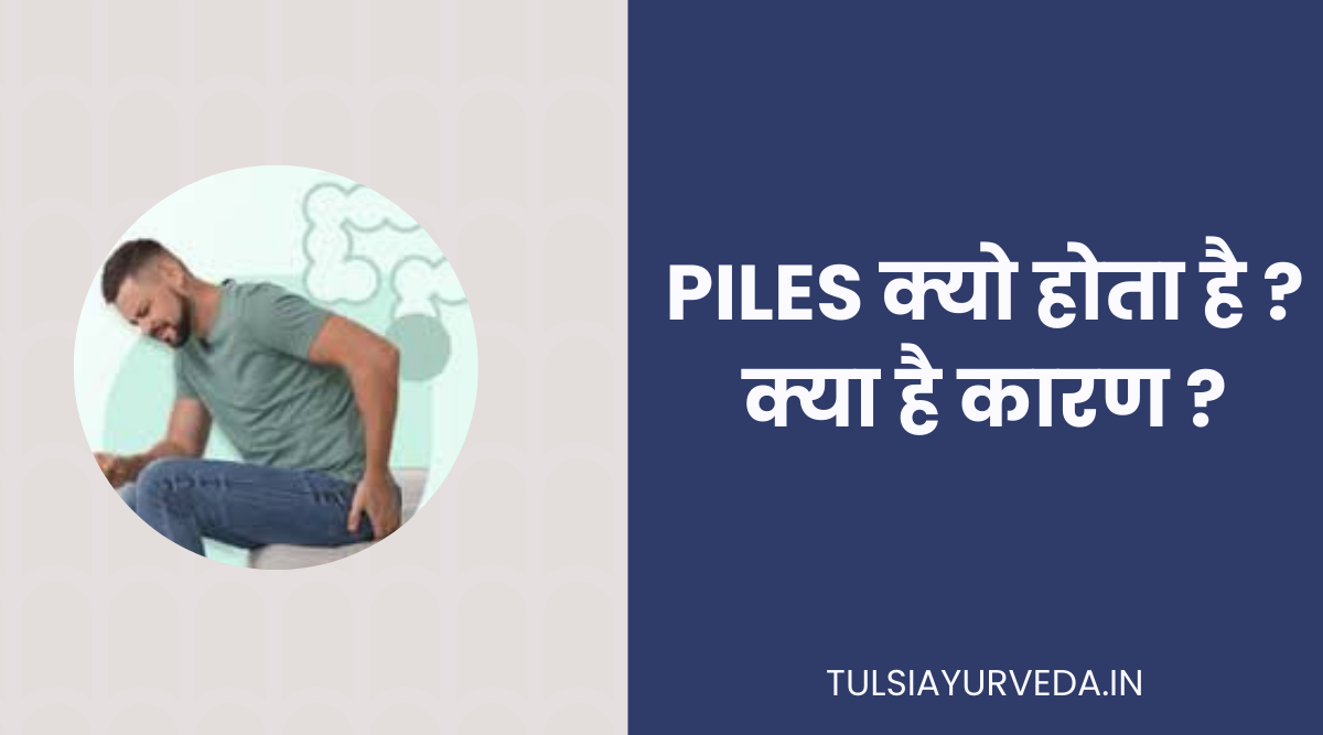 piles क्यो होता है? । क्या है कारण ?